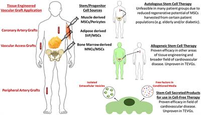 Future Perspectives on the Role of Stem Cells and Extracellular Vesicles in Vascular Tissue Regeneration